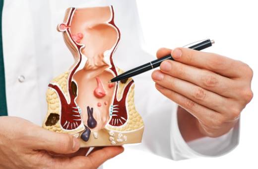 Проктология