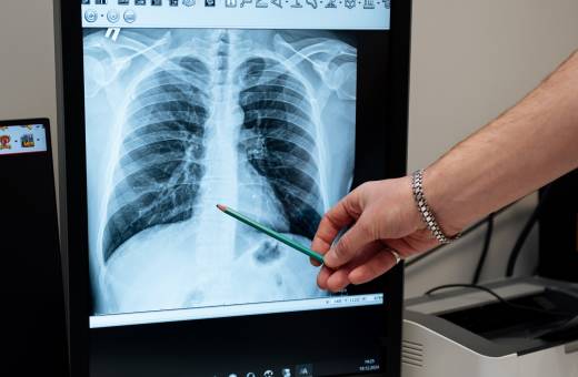 Рентген черепа